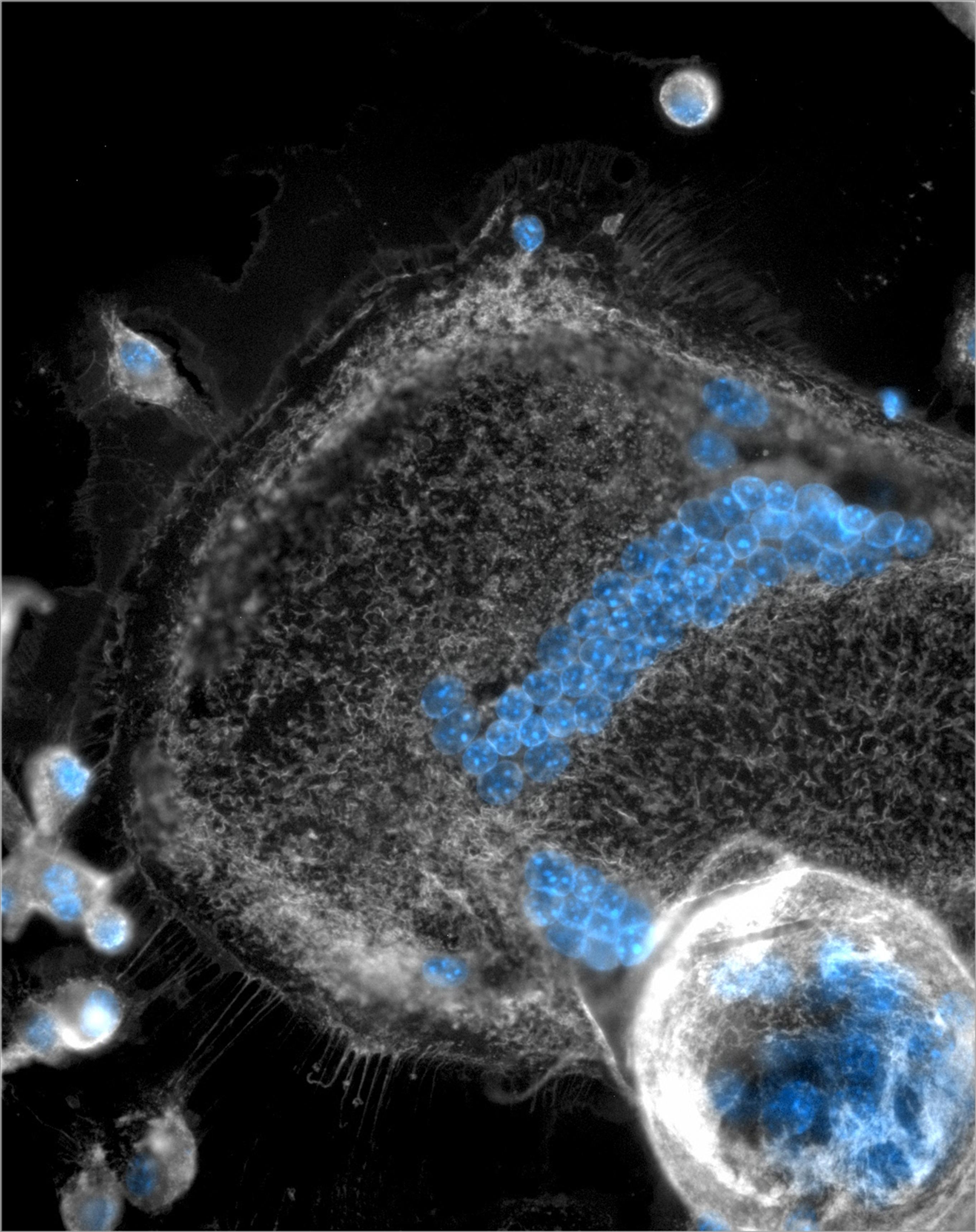MGCs und Fresszellen (Makrophagen) wurden mit Membran-spezifischen (grau) und Zellkern-spezifischen (blau) Farbstoffen gefärbt. Auf dem Bild sind zwei Riesenzellen zu sehen (Mitte und unten links), die von einigen kleineren, einzelligen Fresszellen umgebe