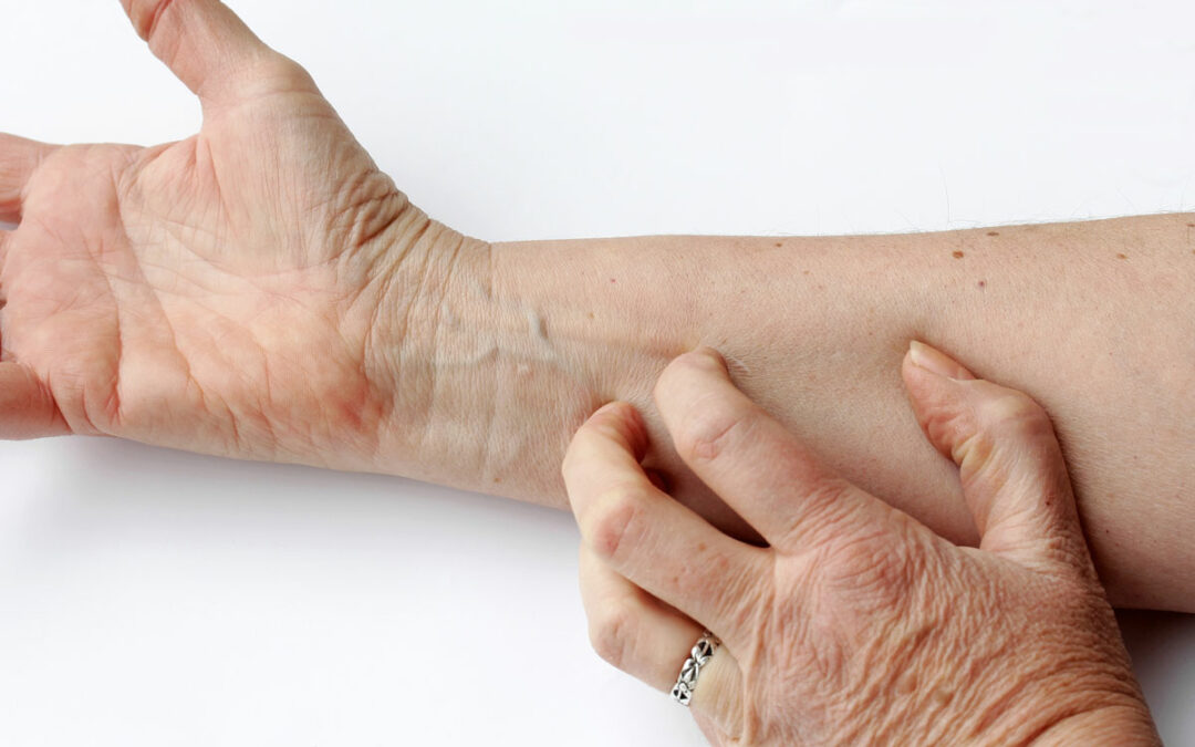 Hautpflegeprogramm für Pflegeheime entwickelt