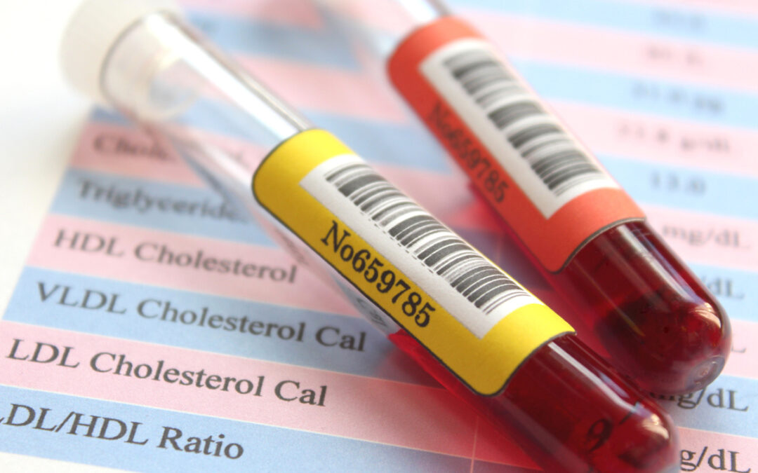 Gefährdung durch hohe HDL-Cholesterinwerte