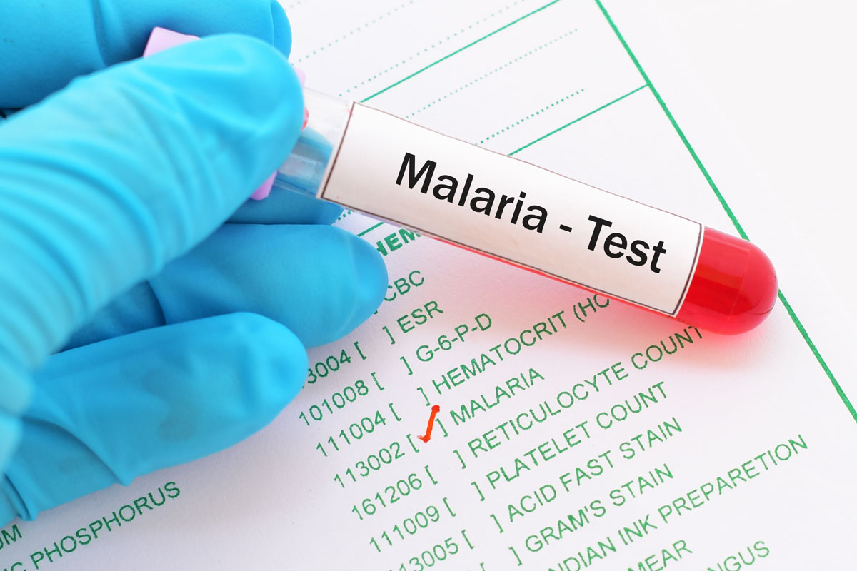 Malaria-Diagnose im Schnelldurchlauf