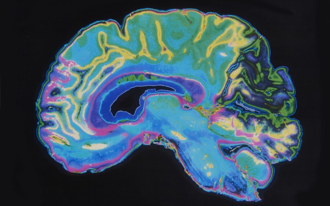 Neue Erkenntnisse über Sauerstoffverbrauch des Gehirns
