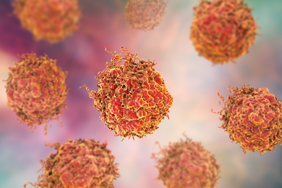 Neue Erkenntnisse über fehlgeleitete Sinalwege in Tumorzellen