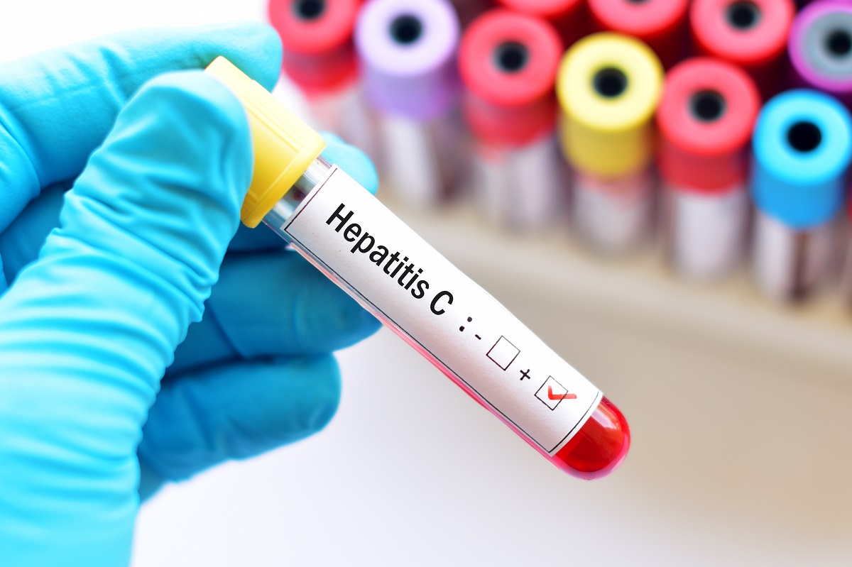 Forderung nach Hepatitis C-Screening
