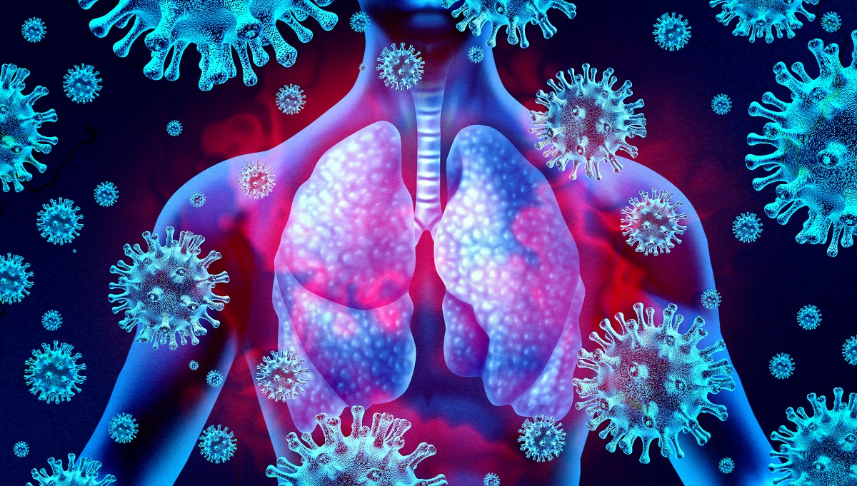Detaillierter Einblick in infiziertes Lungengewebe