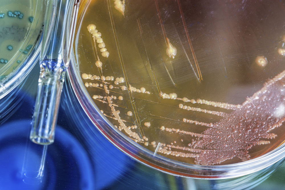 Erforschung des Mikrobioms