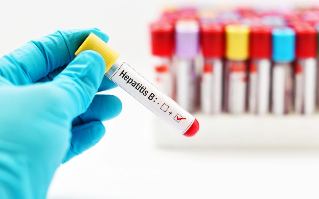 Extrahierung von Hepatitis-B-DNA