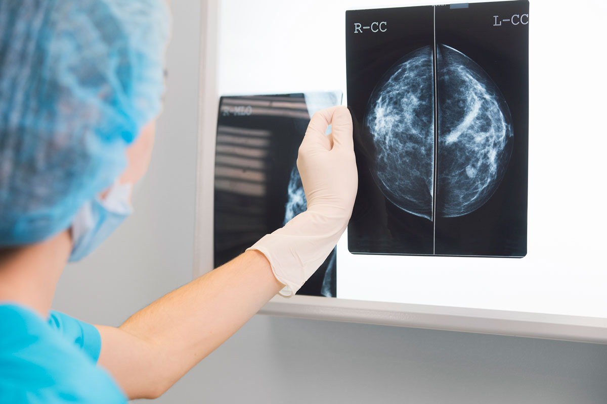 Verbesserung der digitalen Mammographie