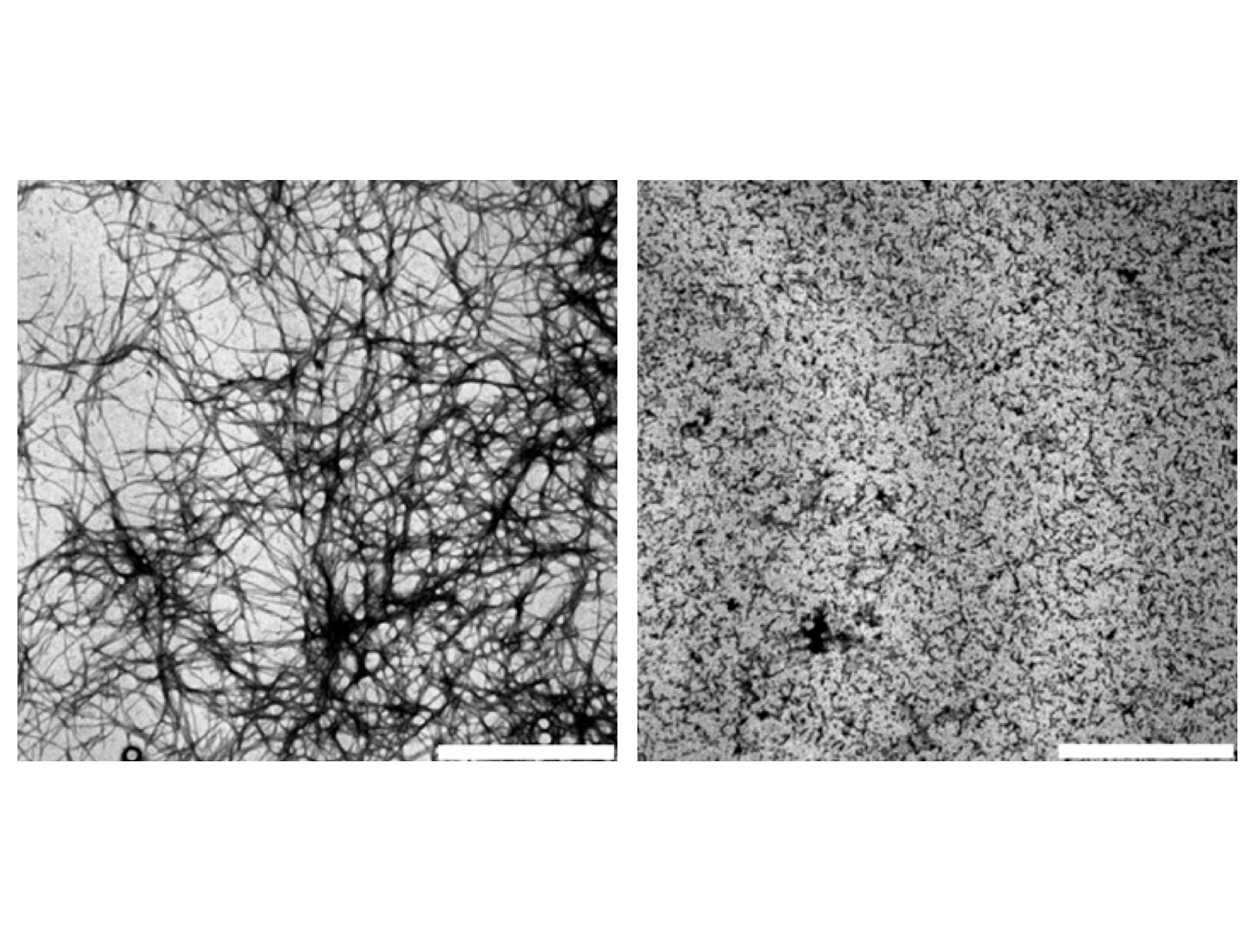 Elektronenmikroskopische Aufnahme von beta-Amyloid in Anwesenheit von alphaB-Crystallin (rechts) und ohne (links). © Andi Mainz / TUM