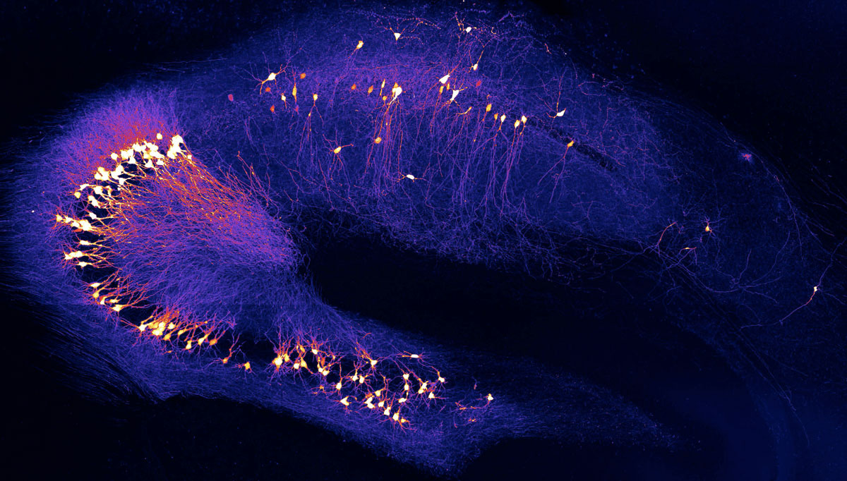 Nervenzellen im Hippocampus. © Y. Zhang und A. Konnerth / TUM
