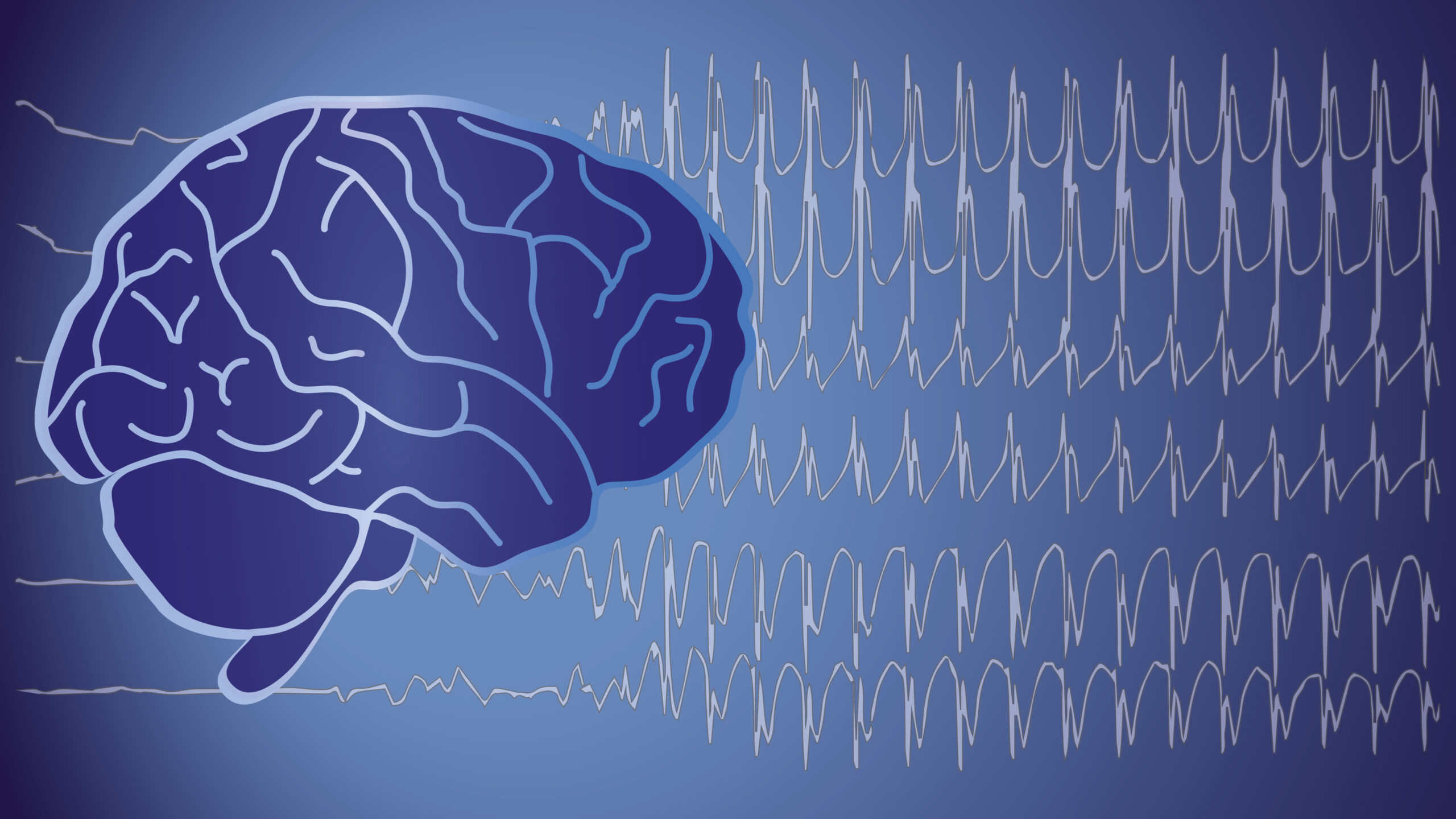 Ausgefeilte Datenanalyse ersetzt riskante Hirn-Stimulation