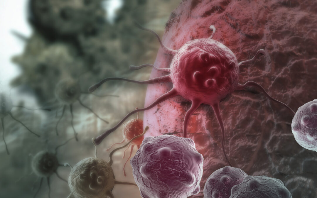 Wie Krebszellen das Knochengewebe verändern