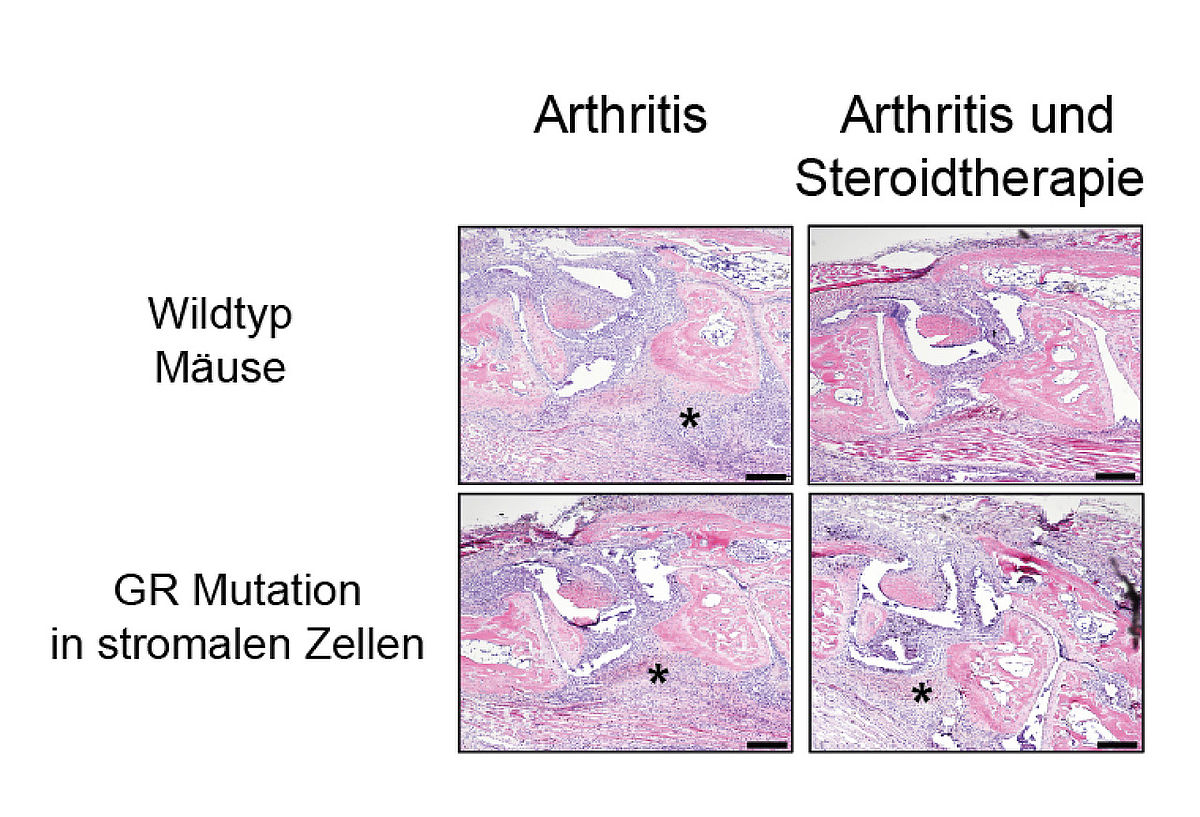 Histologische Untersuchungen von arthritischen Wildtyp-Mäusen © Institut für Molekulare Endokrinologie der Tiere