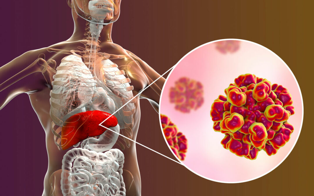 Wechselspiel zwischen Hepatitis-E-Viren und Cholesterin-Stoffwechsel