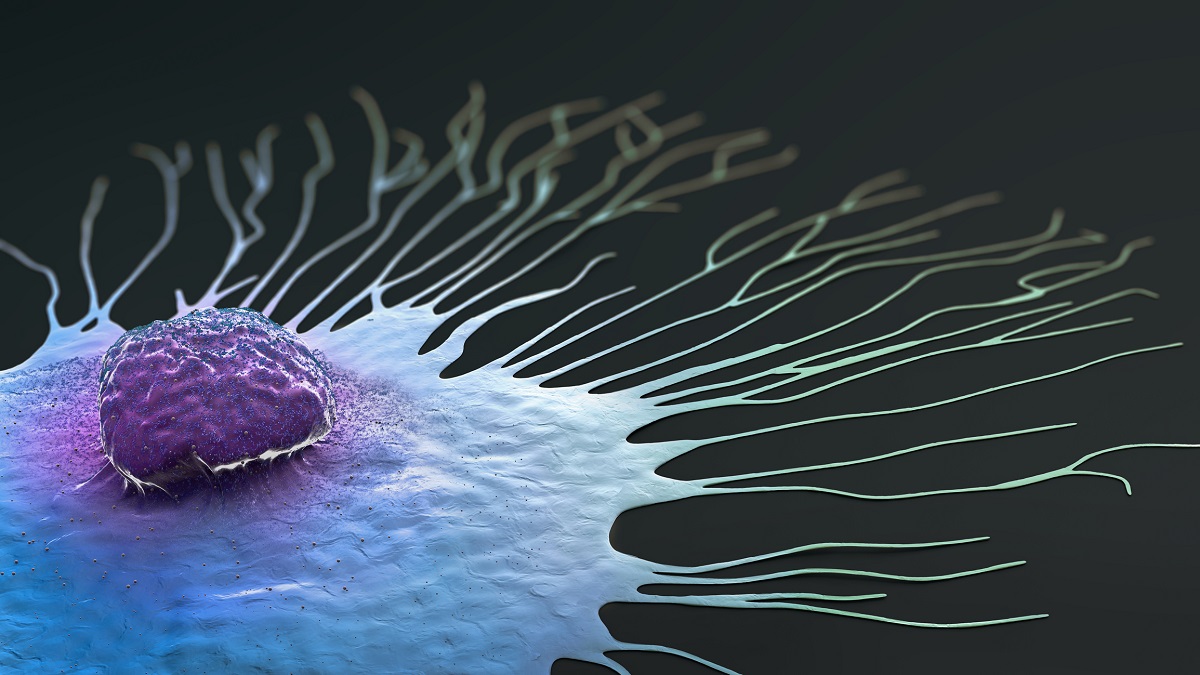 Rolle des YAP-Proteins beim Wachstum von Brustkrebs