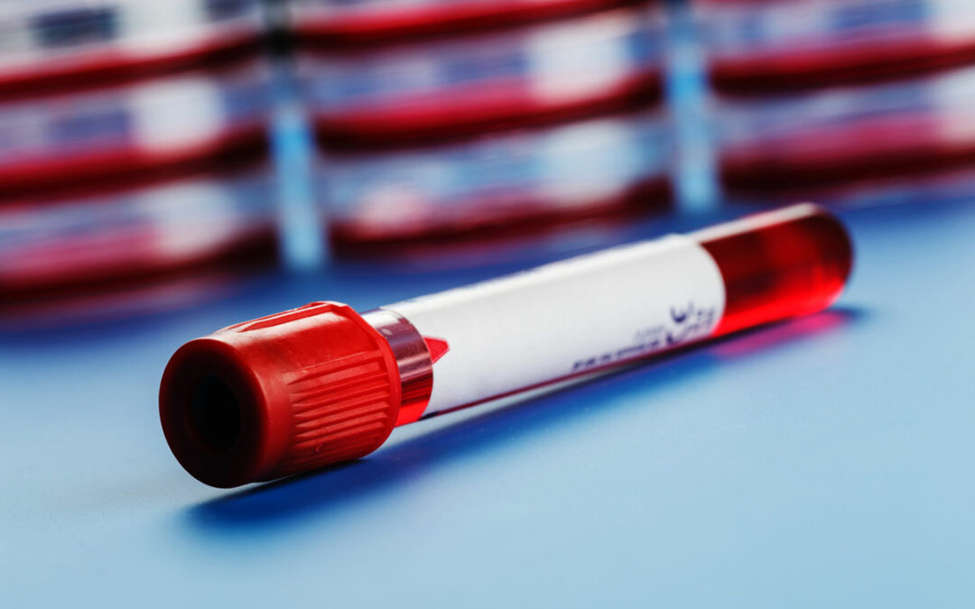 Spenderblut auf Virus testen
