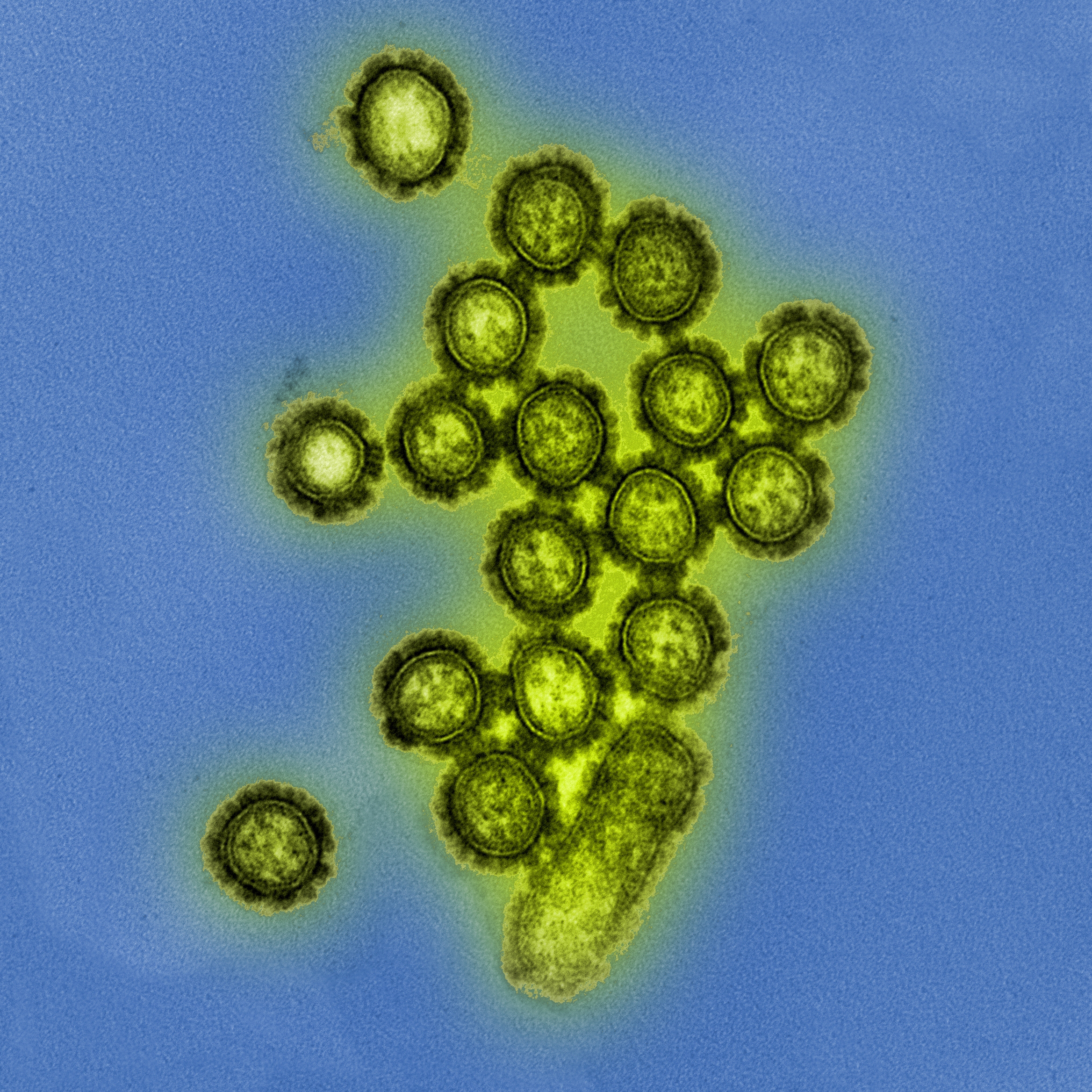 Viruspartikel des Grippeerregers H1N1. © NIAID/CC-BY 2.0