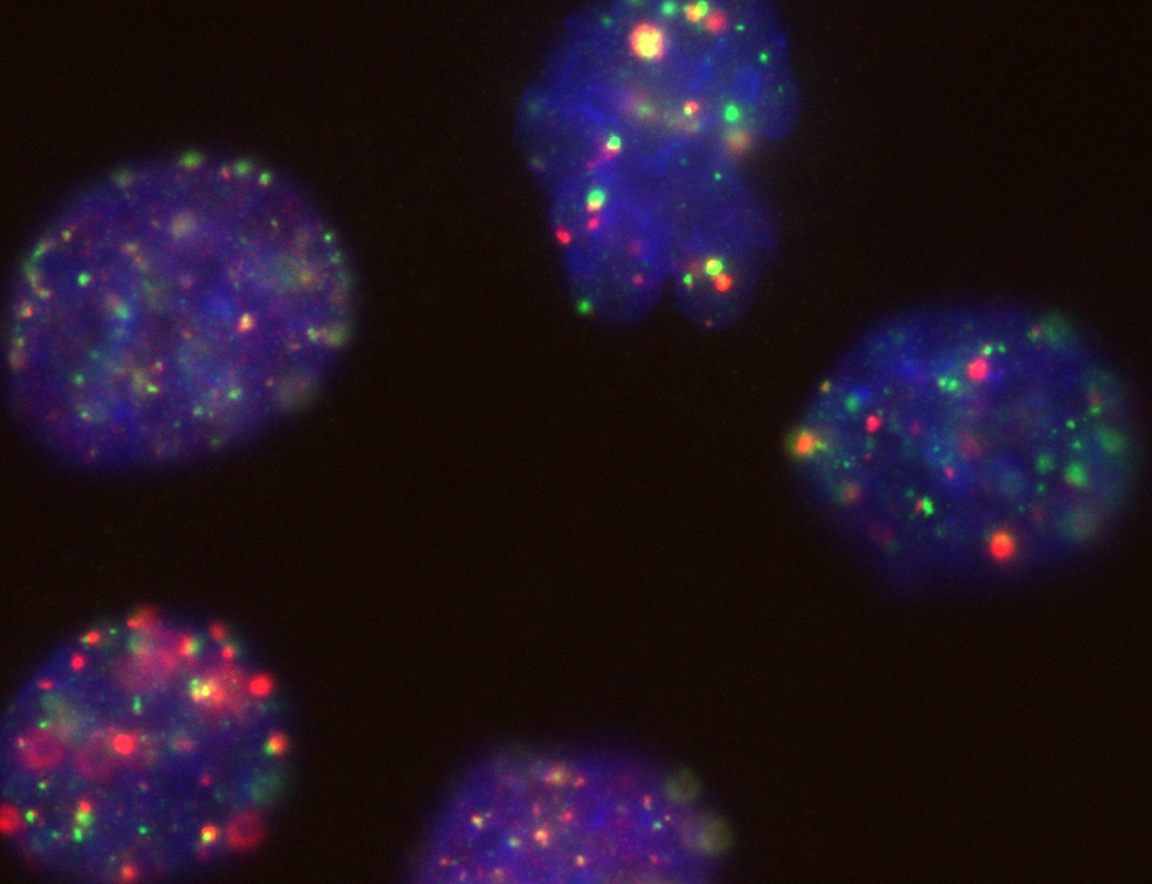 BRCA1-Proteine © Universitätsklinikum Heidelberg