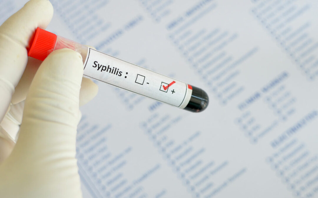 Jahrtausendealte Syphilis-Genome geborgen