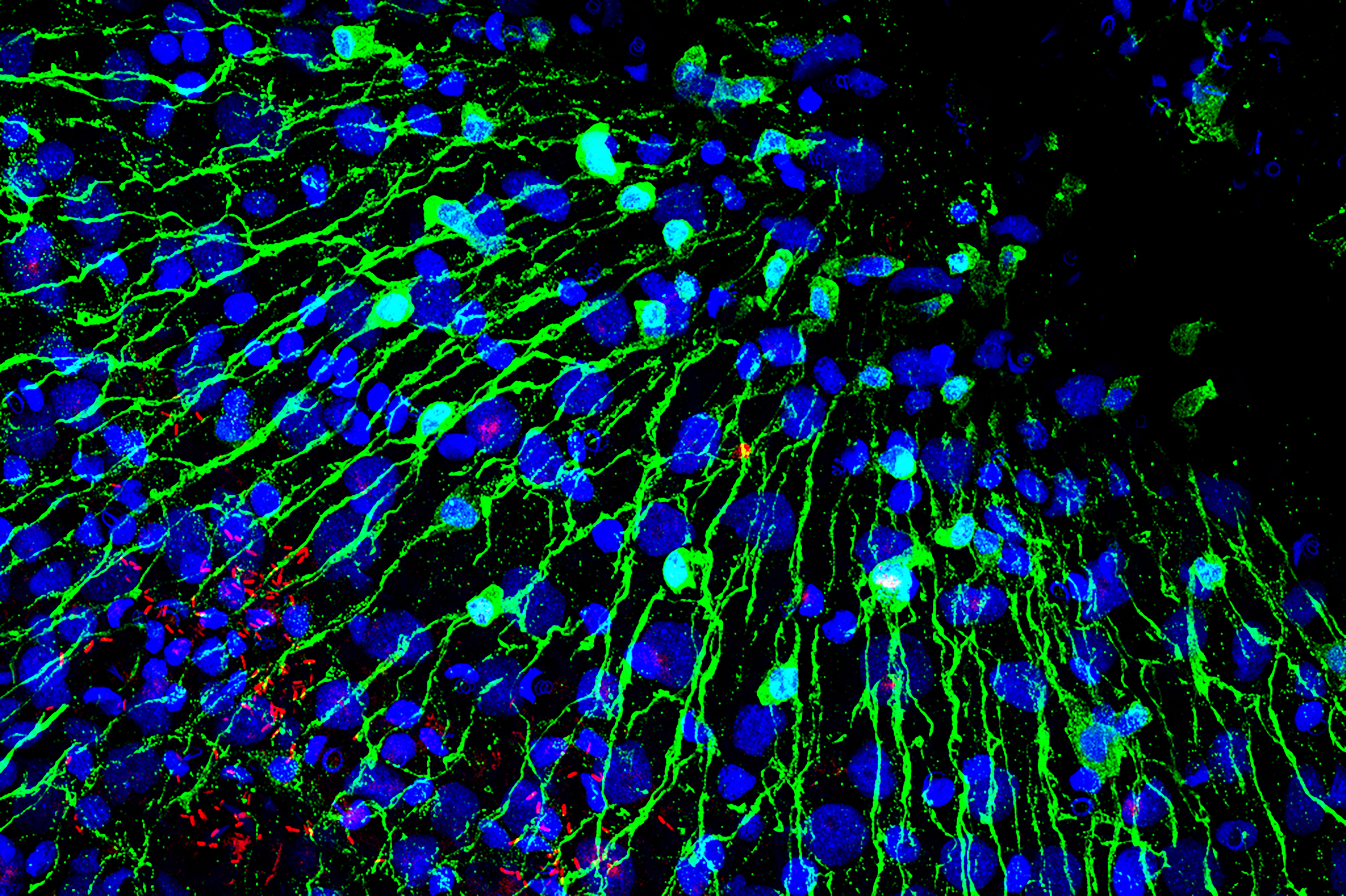 Nervenzellen und Bakterien © Christoph Giez, Dr. Alexander Klimovich