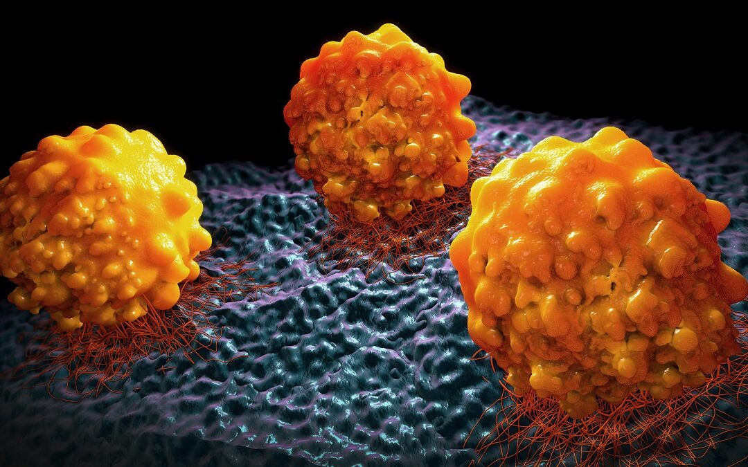 Forscher bestimmen molekulare Beschaffenheit von Tumorgewebe