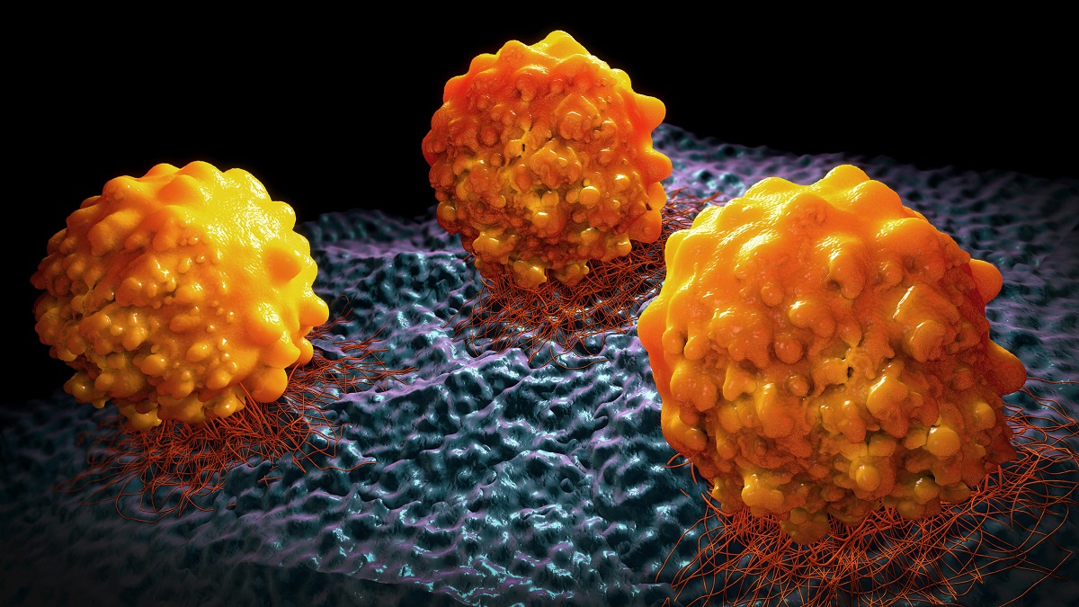 Forscher bestimmen molekulare Beschaffenheit von Tumorgewebe