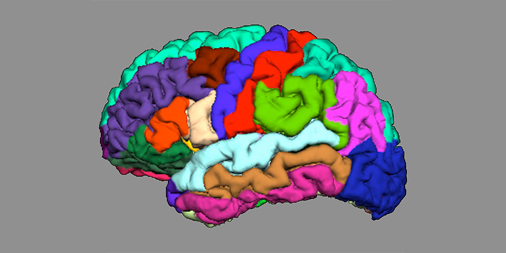 Gehirn © Universität Basel / Universitäre Psychiatrische Kliniken Basel