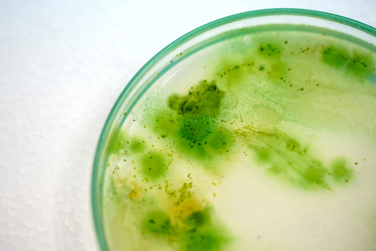 Neue Erkenntnisse zum Cyanobakterium