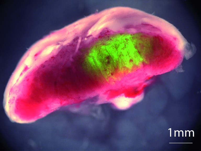 © Kubaczka et al / Cell Stem Cell