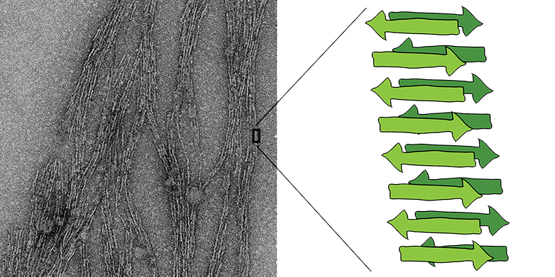 Elektronenmikroskopische Aufnahme einer Amyloid-Faser © ETH Zürich / Jason Greenwald
