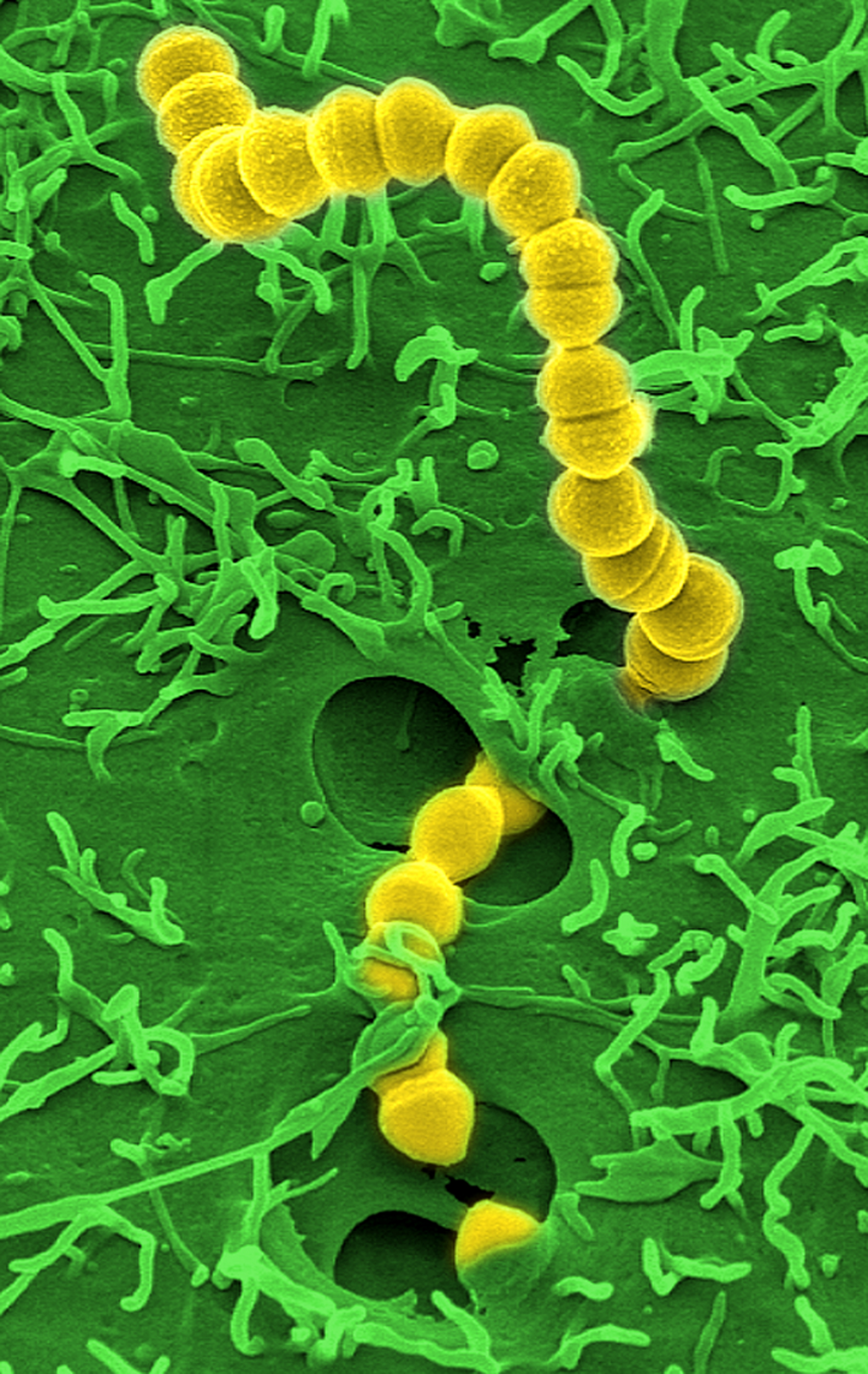 Streptococcus pyogenes © HZI / Manfred Rohde