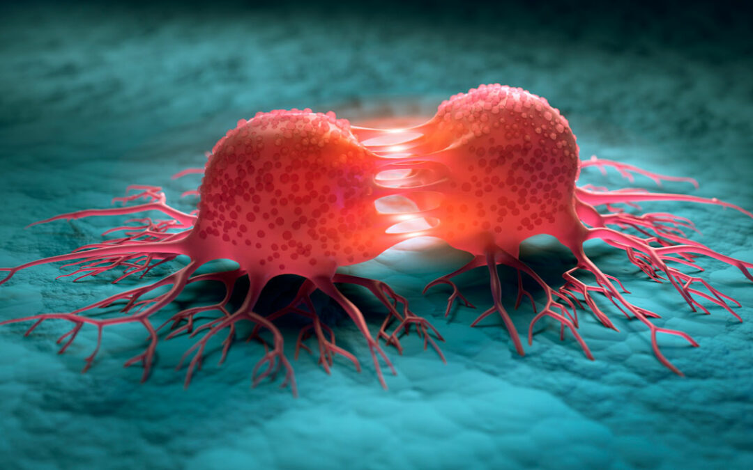 Tumorzellen schwächen mit Milchsäure körpereigene Immunantwort