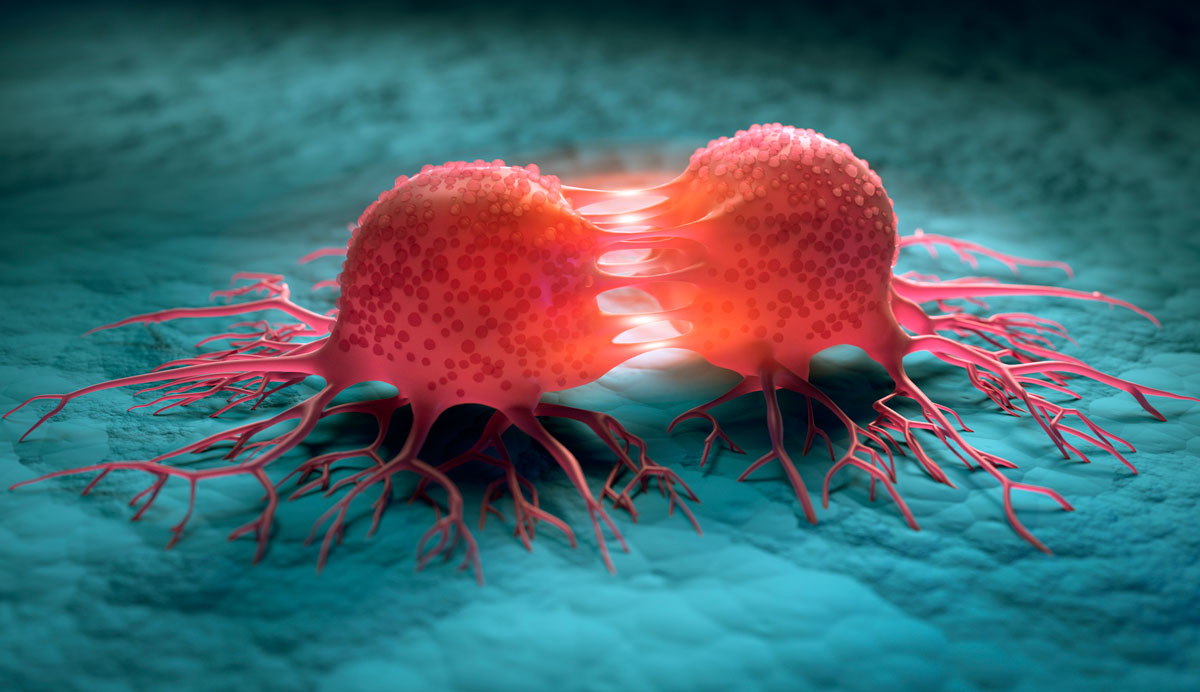 Tumorzellen schwächen mit Milchsäure körpereigene Immunantwort