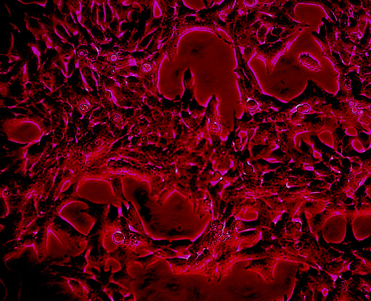 Menschliche Zellen der Nebennieren © Universität Bern
