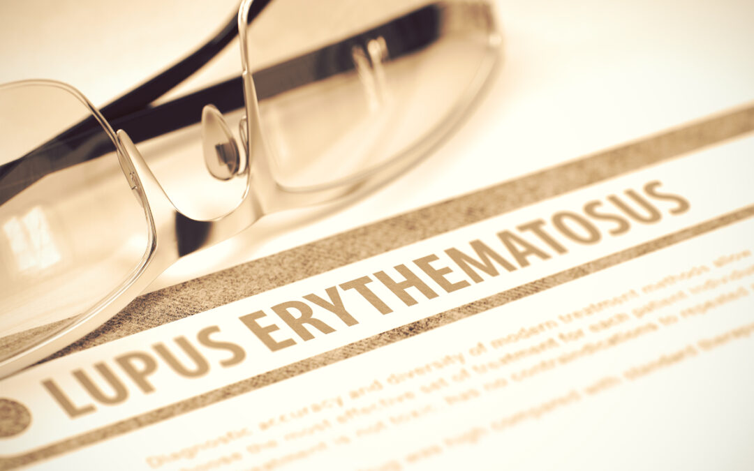 Therapie der Lupus-Nephritis mit Belimumab