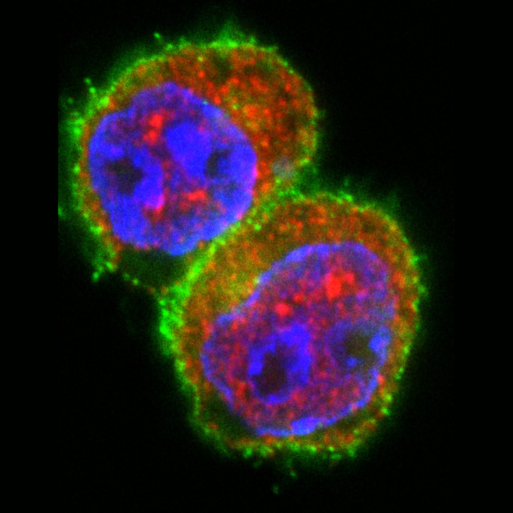 T-Zellen © Helmholtz Zentrum München
