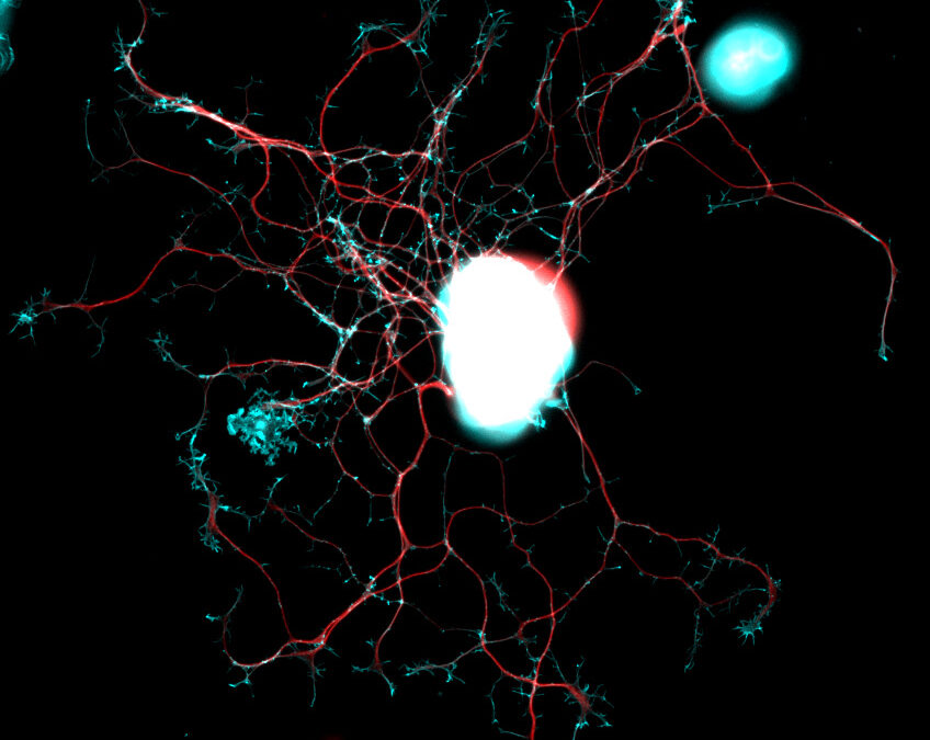 Proteine lassen Nervenzellen nachwachsen
