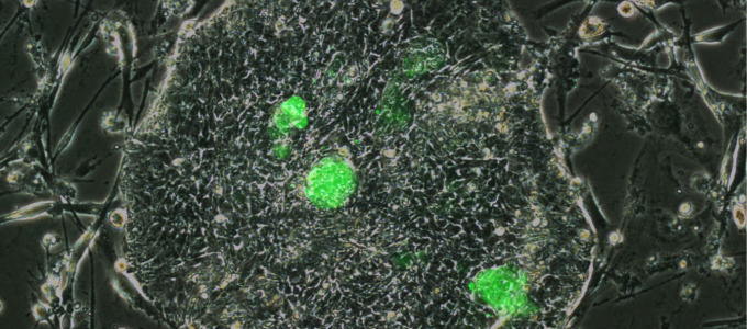 Wie menschliche Stammzellen aufgespürt und im Labor kultiviert werden können