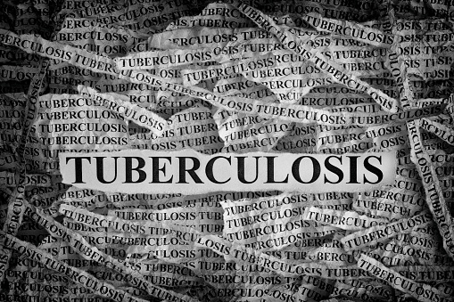 Neuer Angriffspunkt gegen Tuberkulose-Bakterien