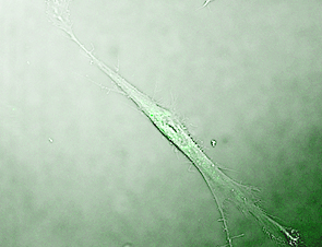 Junge Bindegewebszelle im Mikroskop. © DIfE