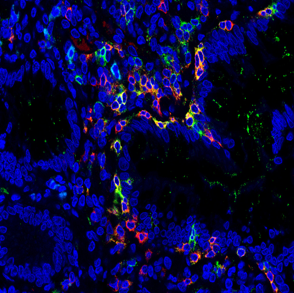 Zellen unter Mikroskop. © Universitätsklinikum Erlangen / Sebastian Zundler