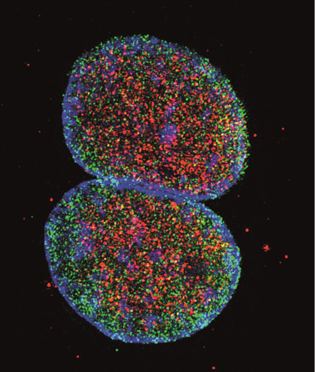 DNA im Zellkern und Virusproteine. © Ramona Businger und Michael Schindler / Universitätsklinikum Tübingen