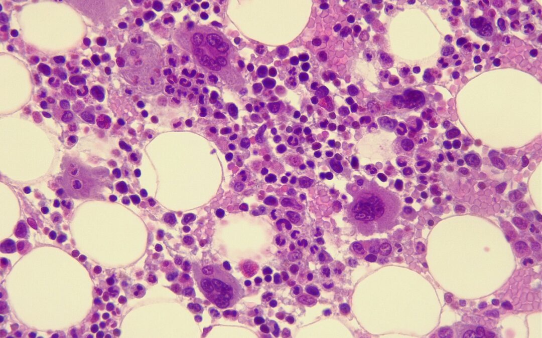 Forschende verjüngen alternde Stammzellen im Knochenmark