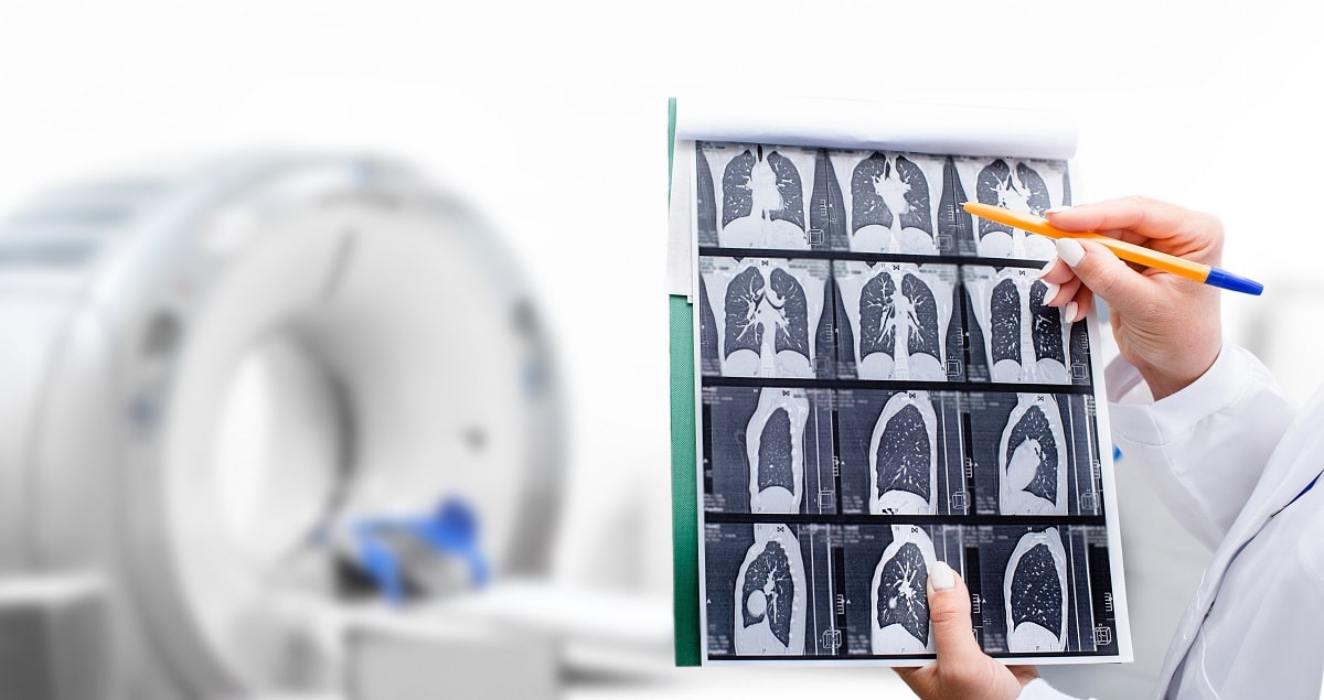 CT-Bilder einer Lunge.