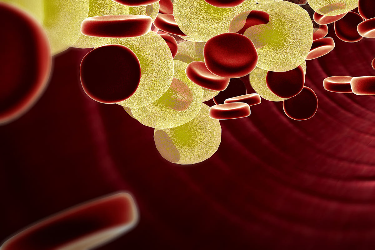 Rote Blutkörperchen und Blutfette.
