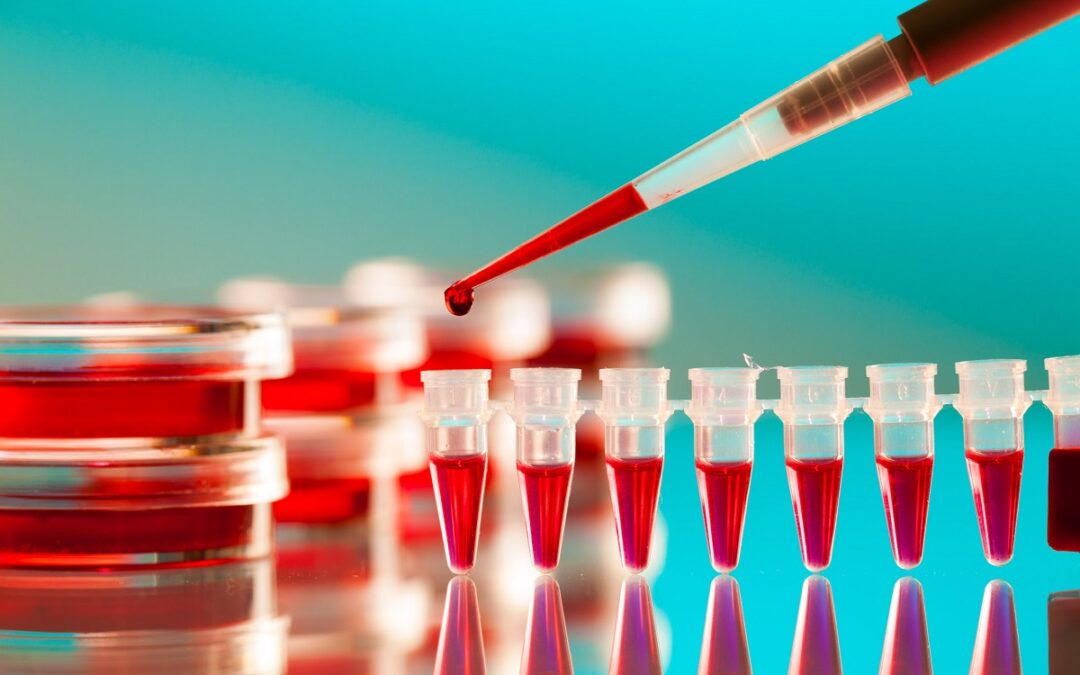 Designerblut aus Stammzellen soll Versorgungsengpässe beseitigen