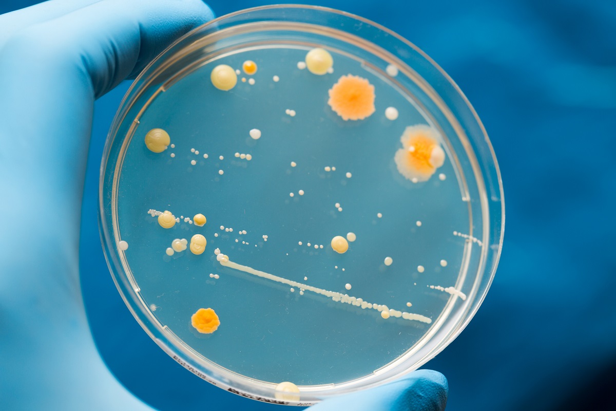 Petrischale mit wachsenden Mikroorganismen.