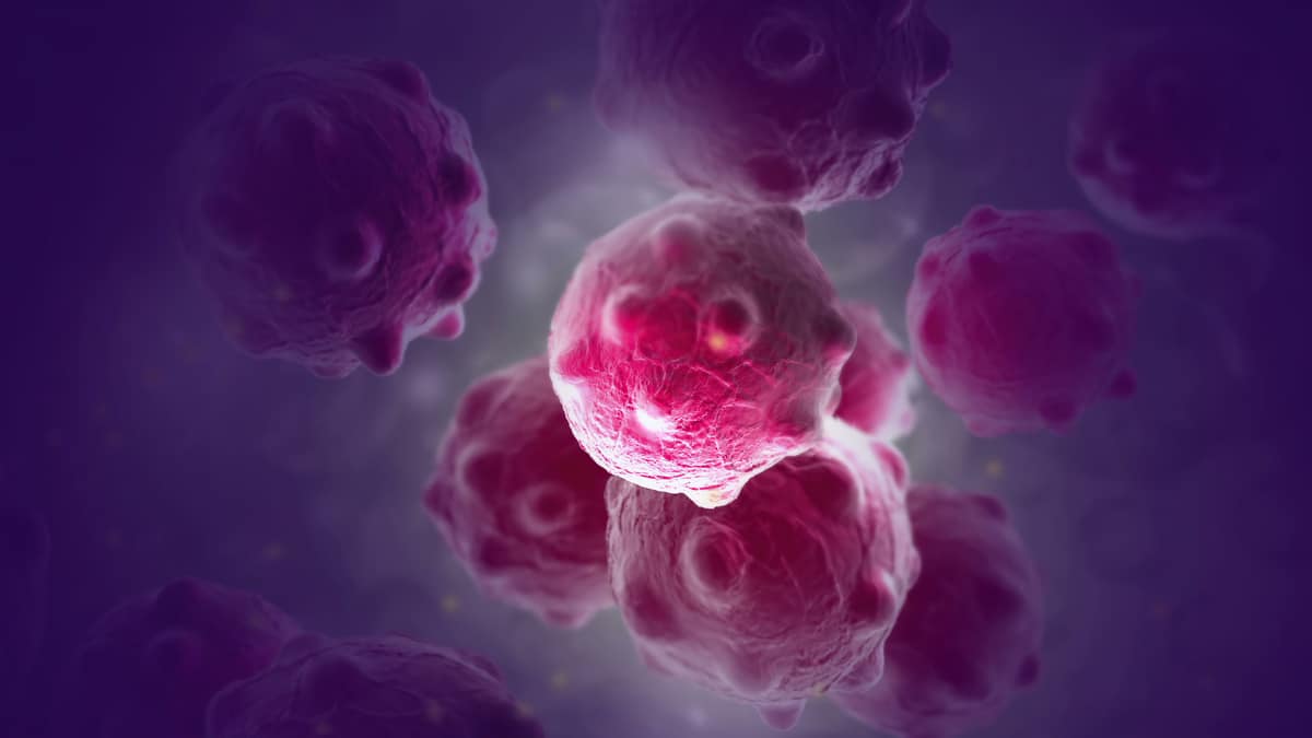 Darstellung von Krebszellen.