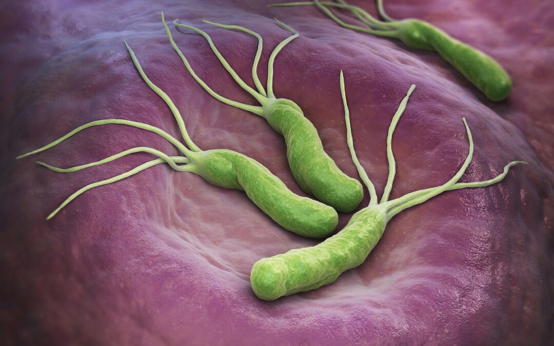 Veränderungen der Magendrüsen durch eine Helicobacter-Infektion