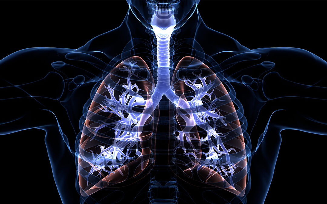 MRT zeigt frühzeitig Lungenveränderungen auf