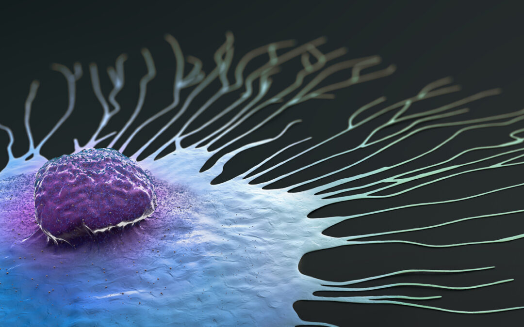 Brustkrebszellen nutzen umprogrammierte Makrophagen zur Ausbreitung